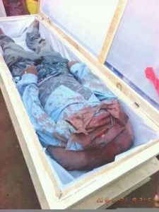 BREAKING!! Fulani Herdsmen Kill Man, Cut Off His Head In Benue State (Graphic Photos) 3 7020646 fbimg1524572563949 jpeg01398eab3d255cb506355d028784591a